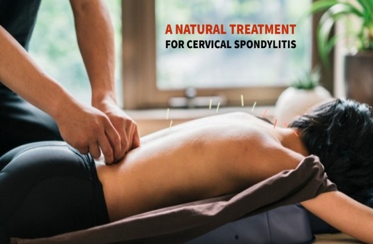 Cervical Spondyliosis  Naturopathy 4